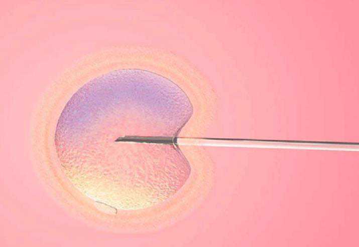卵巢早衰在江门做三代试管婴儿多少钱，