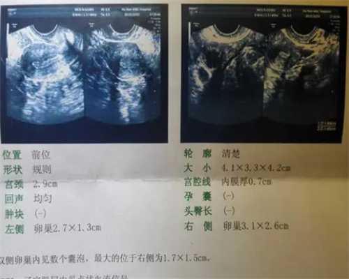 佛山借卵子中心,北京私立供卵机构靠谱吗-为什么做试管要吃维生素D2-囊胚十一
