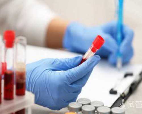 试管移植费用_试管借卵指定,苏州供卵试管医院兰梦试管徴