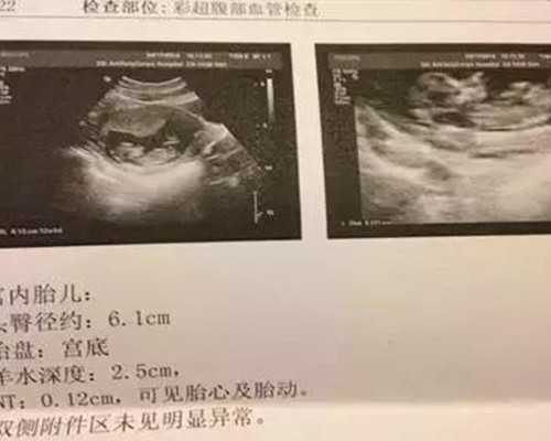 福建代生孩子方案|福建省人类精子库官网