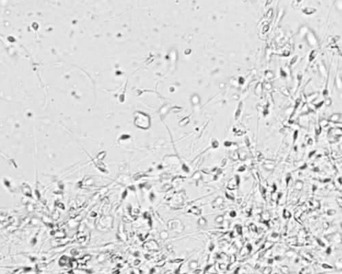 福建包成功代孕网|福建省供卵试管医院,湘雅供卵多少钱一个